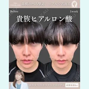 東京シンデレラ美容外科 新宿院 宮﨑友伽医師の症例