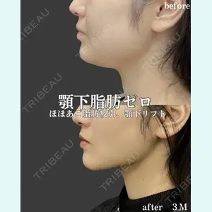 plume clinic 向山 綾子医師の症例