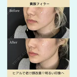 ルラ美容クリニック 静岡院 成田 央良医師の症例