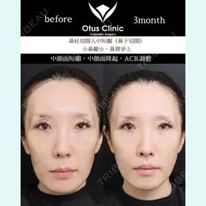 Otus Clinic 【オータスクリニック】 中 徳太郎医師の症例