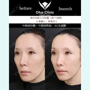 Otus Clinic 【オータスクリニック】 中 徳太郎医師の症例