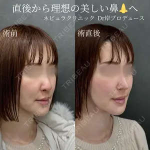 ネビュラクリニック 京都院 岸 大輔医師の症例