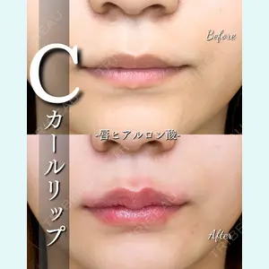 ルラ美容クリニック 大宮院 / ルラスキンクリニック 大宮院 右京 大季医師の症例