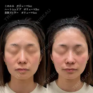 ルラ美容クリニック 池袋院 小海 元医師の症例