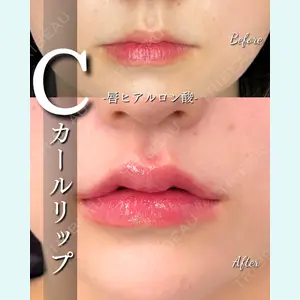 ルラ美容クリニック 大宮院 / ルラスキンクリニック 大宮院 右京 大季医師の症例