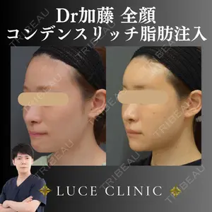 ルーチェクリニック 銀座院 加藤晴之輔医師の症例