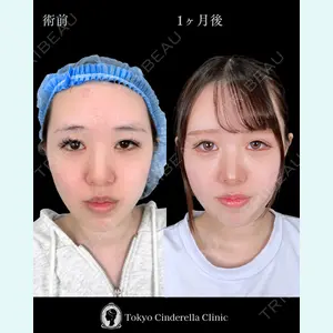 東京シンデレラ美容外科 池袋院 石井 達也医師の症例