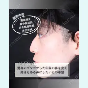 小倉美容外科/美容皮膚科 ビラビューティークリニック 大村 亞蘭医師の症例