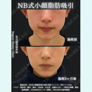 名古屋美容外科 中村 光宏｜医師医師の症例