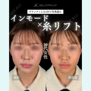 札幌美容外科ネビュラクリニック 横田 開医師の症例