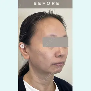 横浜山手クリニック 平山 桂子医師の症例