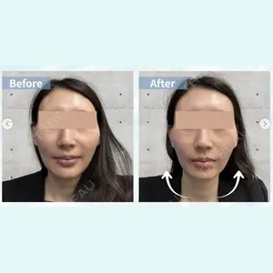 Y.CLINIC 肥田安紀子医師の症例