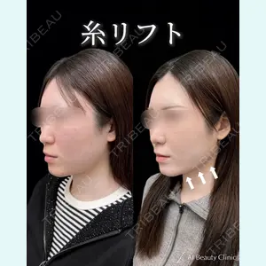 AI Beauty Clinic （エーアイ美容クリニック） 田中 里佳医師の症例