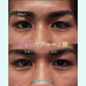 症例