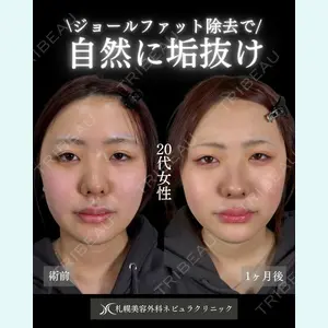 ネビュラクリニック 広島院の症例