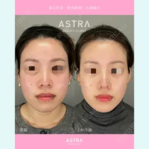 ASTRA BEAUTY CLINIC 河口 はるか医師の症例