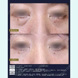 聖心美容クリニック 広島院 中辻 隆徳医師の症例