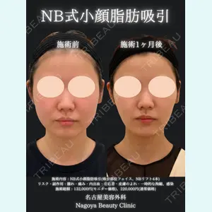 名古屋美容外科 中村 光宏｜医師医師の症例