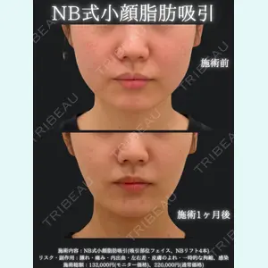 名古屋美容外科 中村 光宏｜医師医師の症例