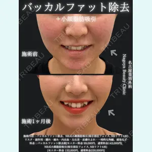 名古屋美容外科 中村 光宏｜医師医師の症例