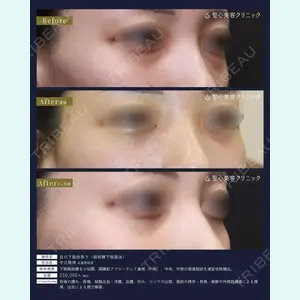 聖心美容クリニック 広島院 中辻 隆徳医師の症例