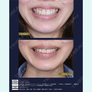 聖心美容クリニック 広島院 中辻 隆徳医師の症例