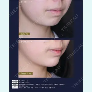 聖心美容クリニック 広島院 中辻 隆徳医師の症例