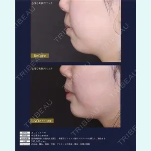 聖心美容クリニック 広島院 中辻 隆徳医師の症例