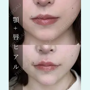 ルラ美容クリニック 大宮院 / ルラスキンクリニック 大宮院 右京 大季医師の症例