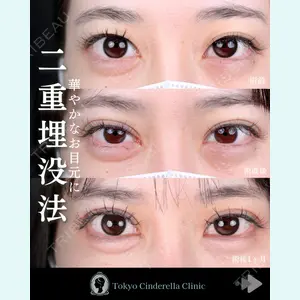 東京シンデレラ美容外科 池袋院 石井 達也医師の症例