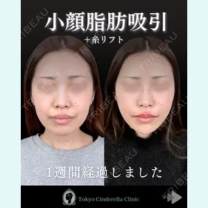 東京シンデレラ美容外科 池袋院 石井 達也医師の症例