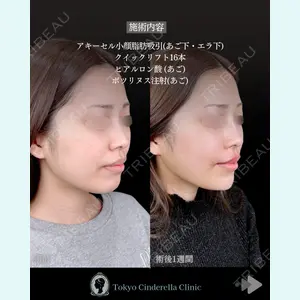 東京シンデレラ美容外科 池袋院 石井 達也医師の症例