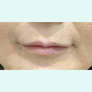 症例