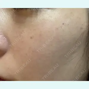 エクラクリニック 大宮 久能 亜美医師の症例