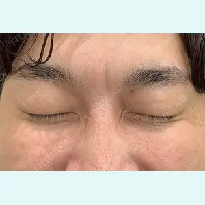 エクラクリニック 大宮 久能 亜美医師の症例