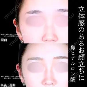 アリエル美容クリニック 水戸院 天白 典秀医師の症例