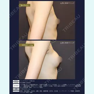 聖心美容クリニック 広島院 中辻 隆徳医師の症例