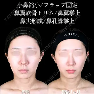 アリエル美容クリニック 大宮院 阪野 一世医師の症例