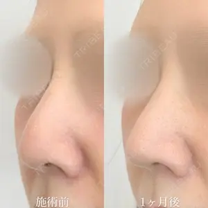 TCB東京中央美容外科 熊本院 垣花 瑠美子医師の症例