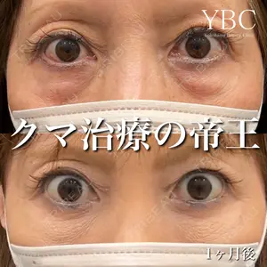 YBC横浜美容外科 大宮院 磯村 亮輔医師の症例