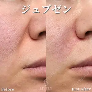 ライブリークリニック 大阪院の症例