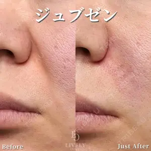 ライブリークリニック 大阪院の症例