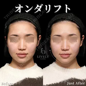 ライブリークリニック 大阪院の症例