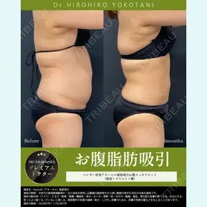 湘南美容クリニック 大阪梅田本院 横谷 仁彦医師の症例