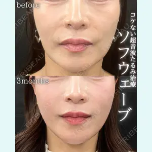 THE FIRST CLINIC 町田院 木暮 啓一郎医師の症例