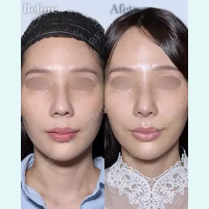 eクリニック 横浜みなとみらい院 坂本 優衣医師の症例