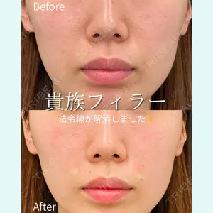 ルラ美容クリニック 仙台院 / ルラスキンクリニック 仙台院 橋本 英樹医師の症例