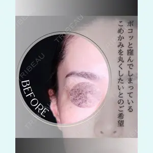 小倉美容外科/美容皮膚科 ビラビューティークリニック 大村 亞蘭医師の症例