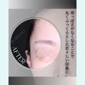 小倉美容外科/美容皮膚科 ビラビューティークリニック 大村 亞蘭医師の症例