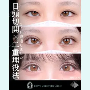 東京シンデレラ美容外科 池袋院 石井 達也医師の症例